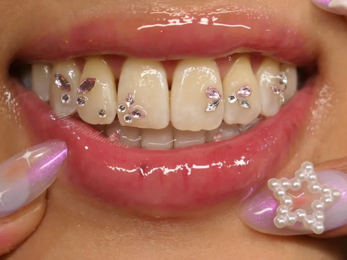 The finished custom tooth gem set on the client, with pink butterfly gems across the upper teeth