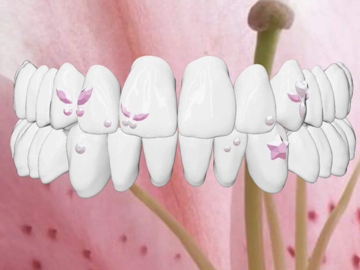 Smile map of a custom tooth gem set with pink butterfly gems across the upper teeth